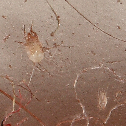 ID microacari